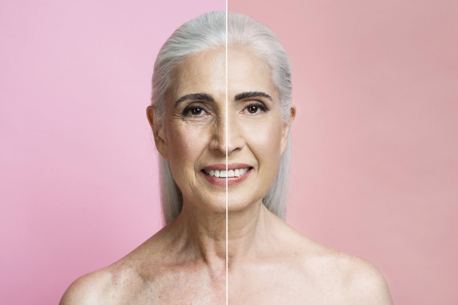 Armonización Orofacial